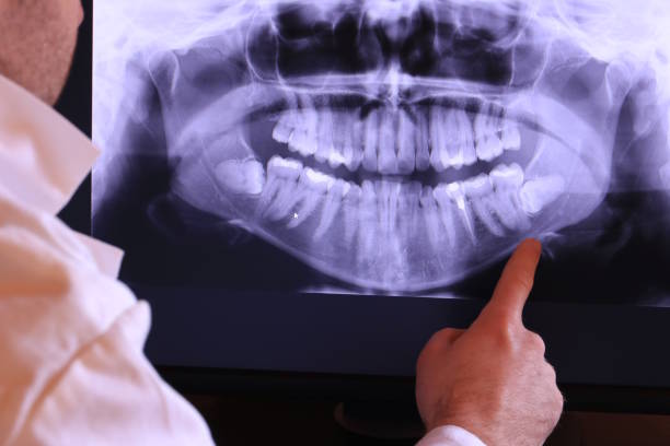 Best Emergency Wisdom Teeth Removal in Washington, UT
