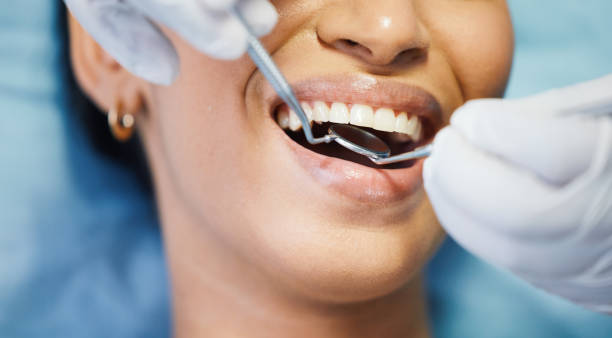 Best Emergency Dental Care for Broken or Chipped Teeth in Washington, UT
